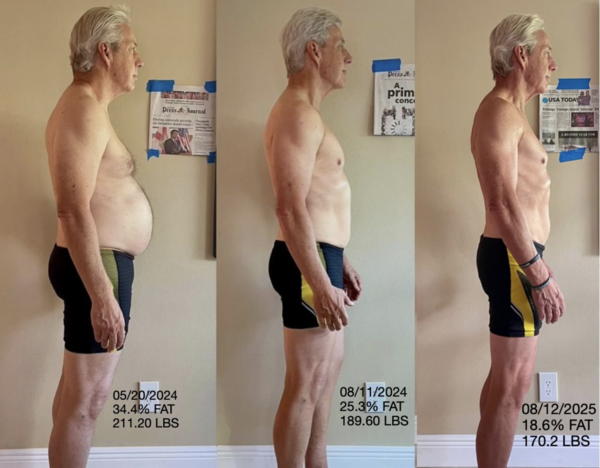 Scot's Before and After Photos.
