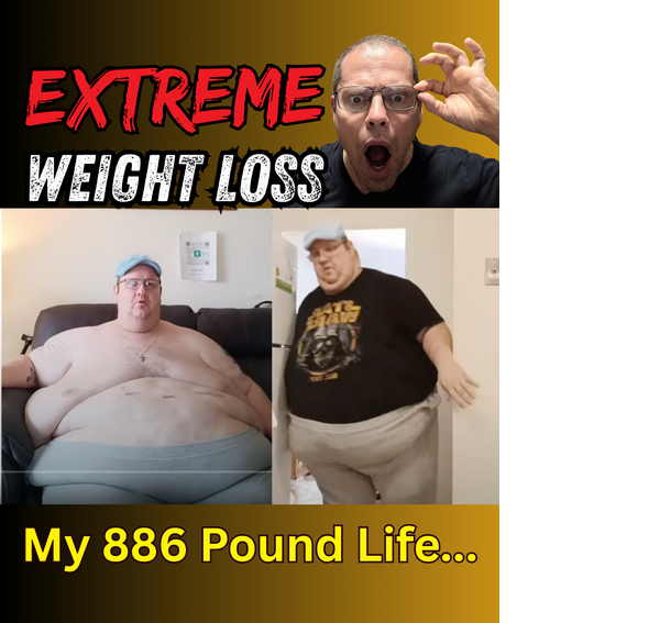 Extreme Weight Loss Story
